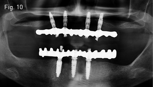 Toronto Köprü